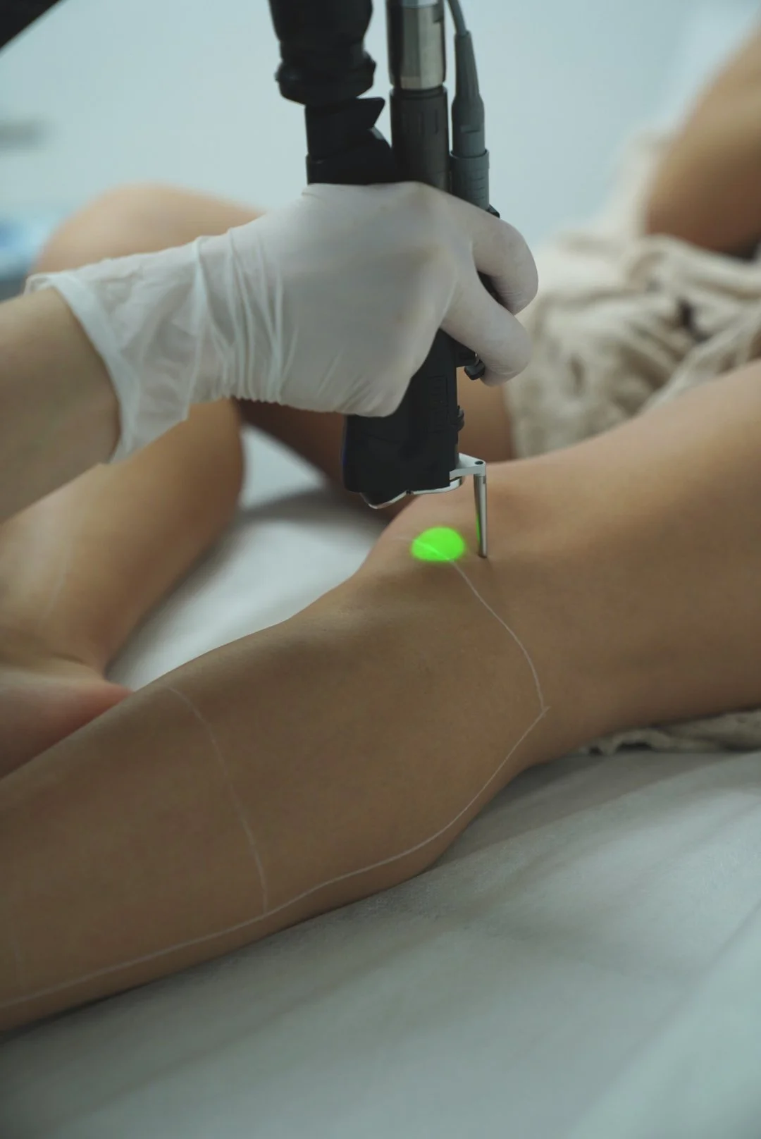 How Laser Hair Removal Works