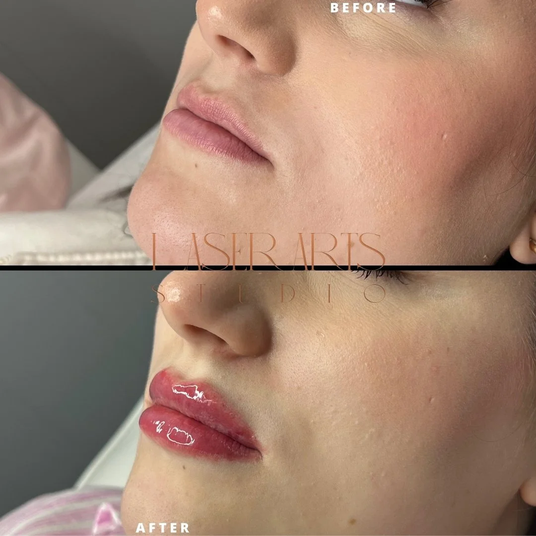 Simple Photocentric Before and After Instagram Post.zip - 4.JPG