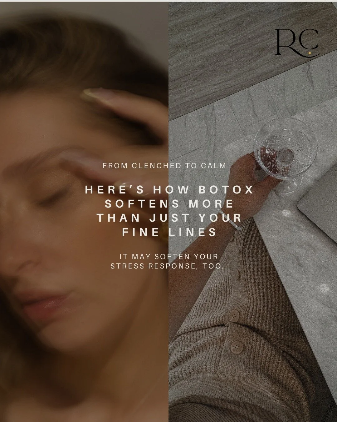 Do you notice tension lines that make you look tired, stressed, or tense even when you feel fine? Many people think expression lines are only about aging, but often they reflect muscle patterns that have been holding stress for years.

When the body 