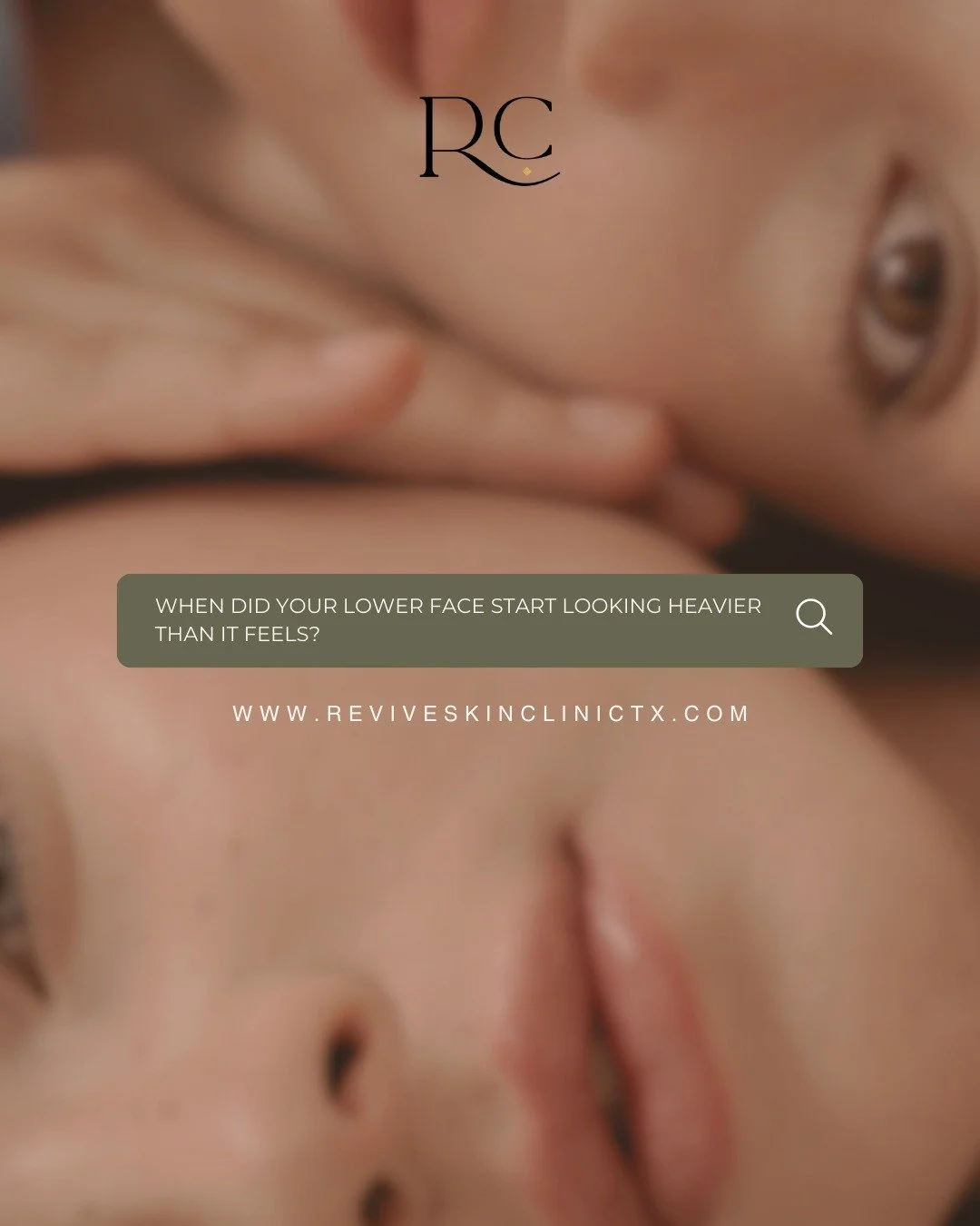 If your jawline feels softer, your chin looks fuller, or early jowls are starting to appear, you are not alone. These changes often begin before we expect them and are usually related to collagen decline and tissue laxity.

Endolift is a minimally in