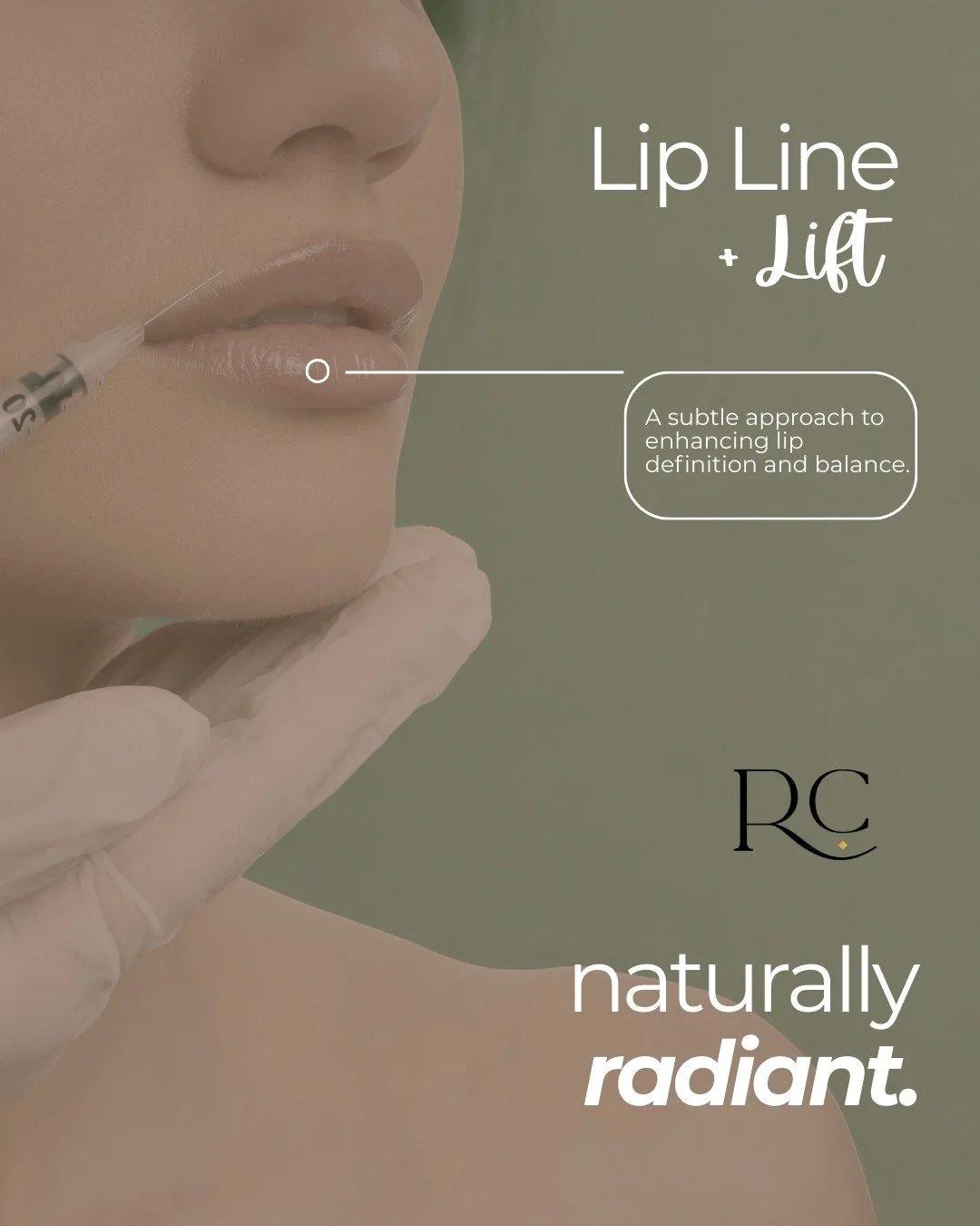 The lips can gradually change over time as collagen production slows and natural structure begins to soften.

This may result in lips that appear thinner or lip borders that become less defined.

Lip Line + Lift treatments focus on restoring subtle s