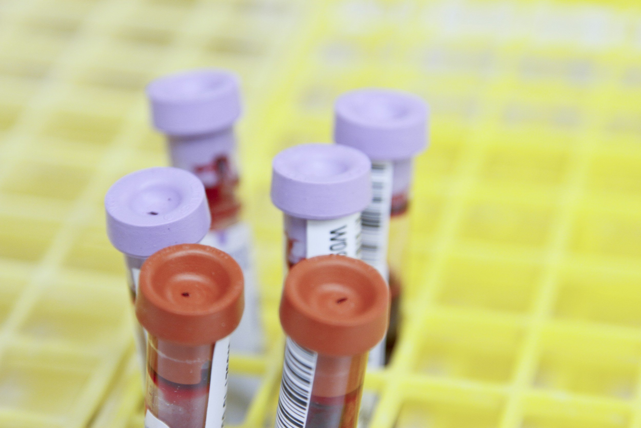 Blood test tubes and vials for laboratory testing, representing the new Alzheimer's biomarker blood test now available through LifeLabs in BC.
