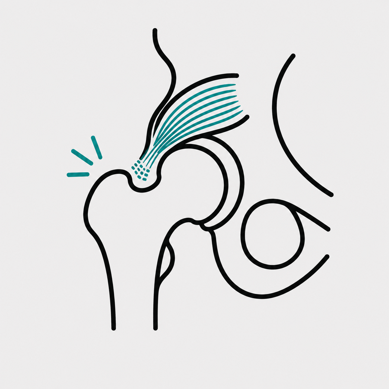 Muscle Weakness