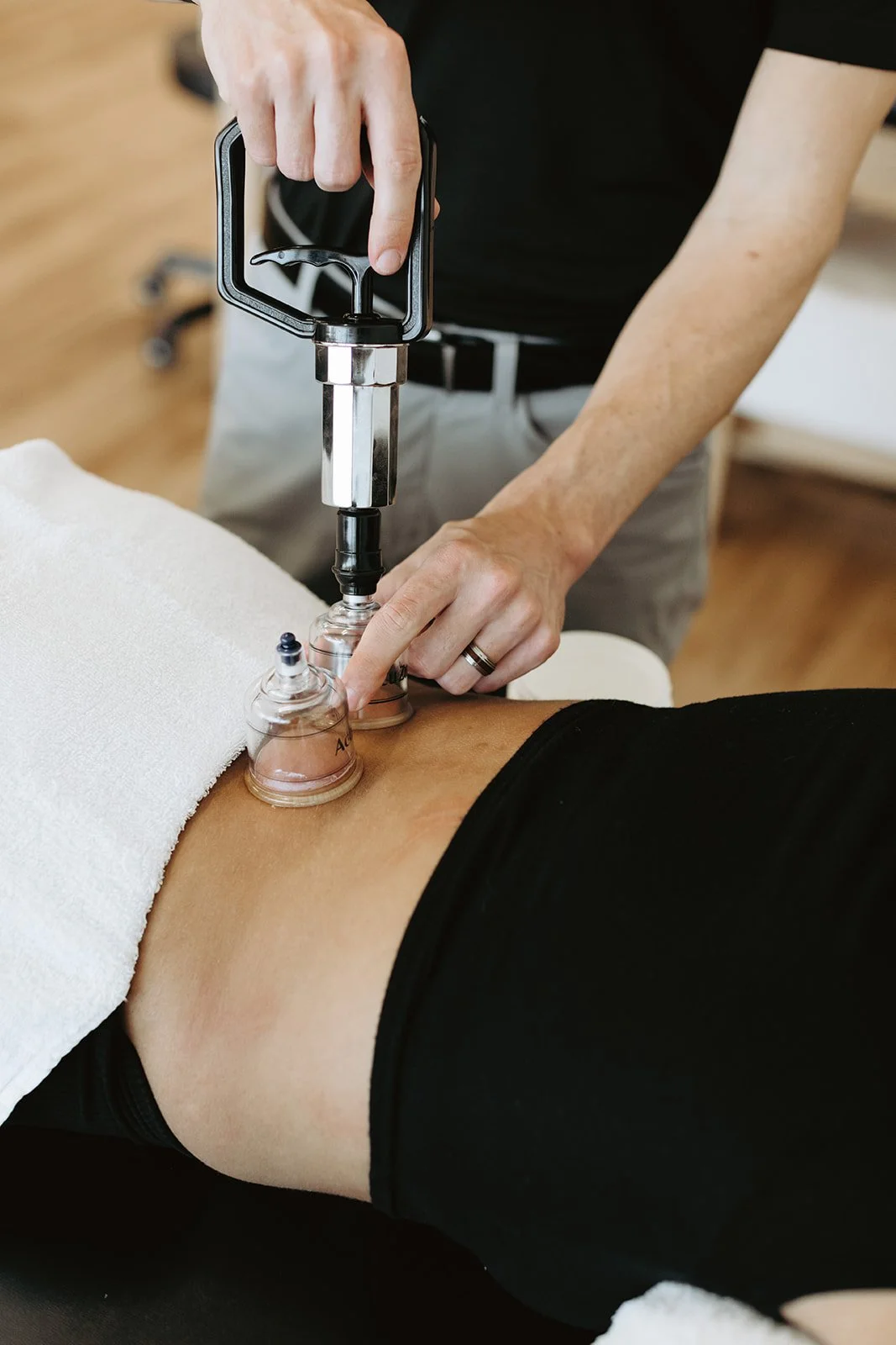Cupping Therapy 