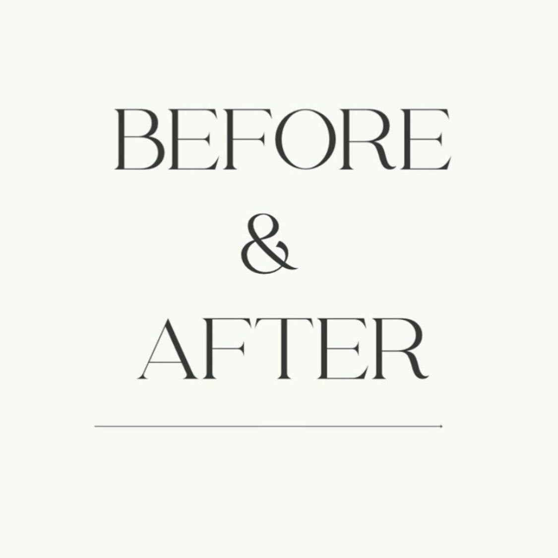 The magic that happens when you trust the process ✨

Our beautiful client&rsquo;s skin has transformed remarkably, overcoming scarring, breakouts, and pigmentation. With her commitment to our recommended skincare products, peels, infusions, and derma