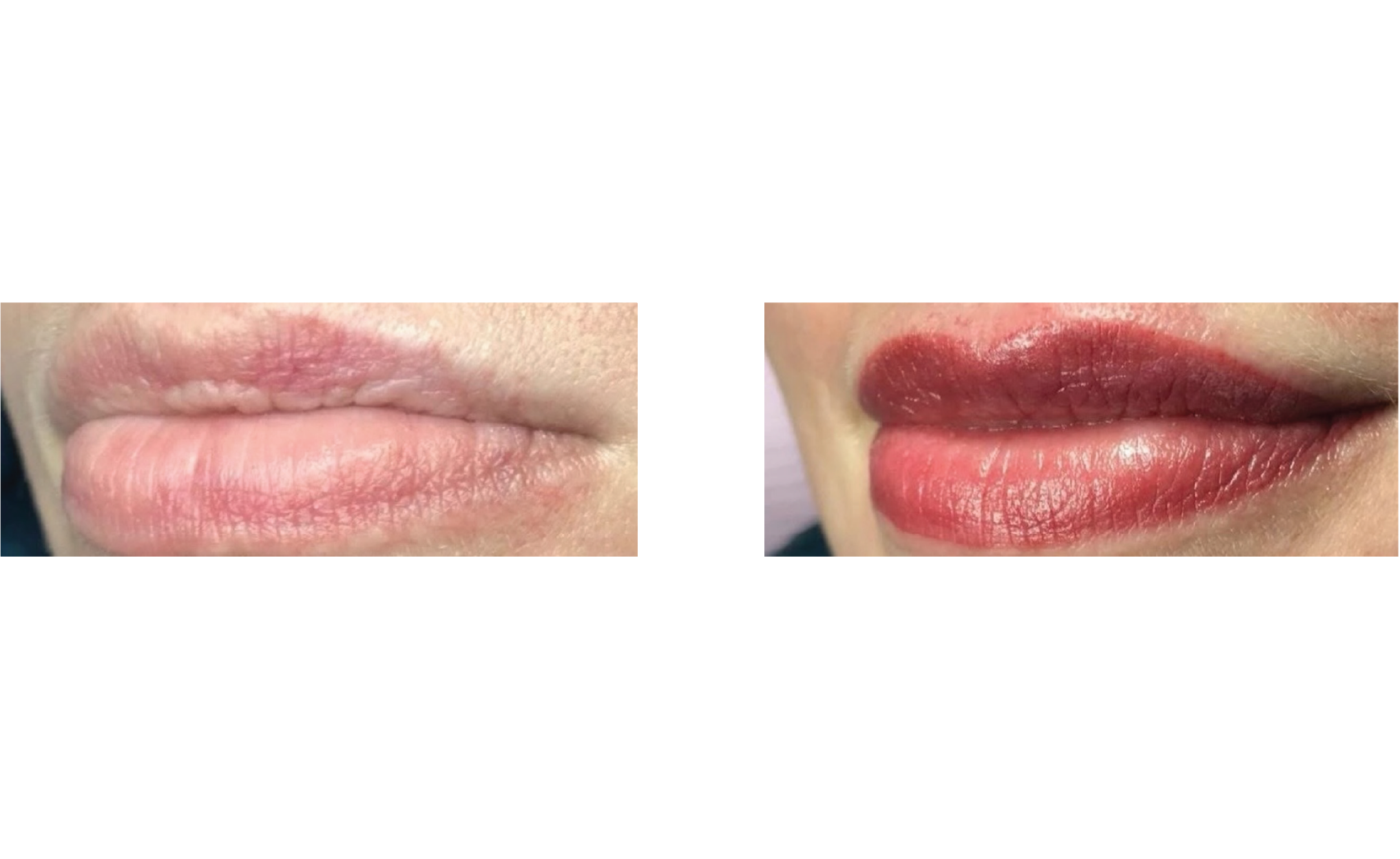 Before & After Lips.png