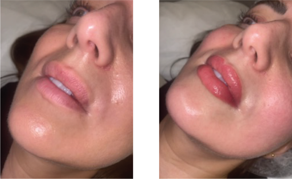 Before & After Template 26 Jul 2026.png