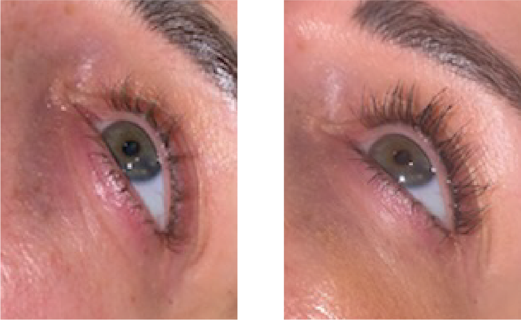 Before & After Template 26 Jul 2026 Lashes.png