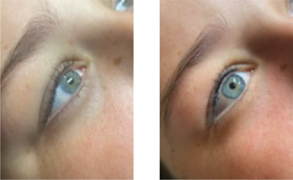 Before & After Template 26 Jul 2026 Eye Liner.png