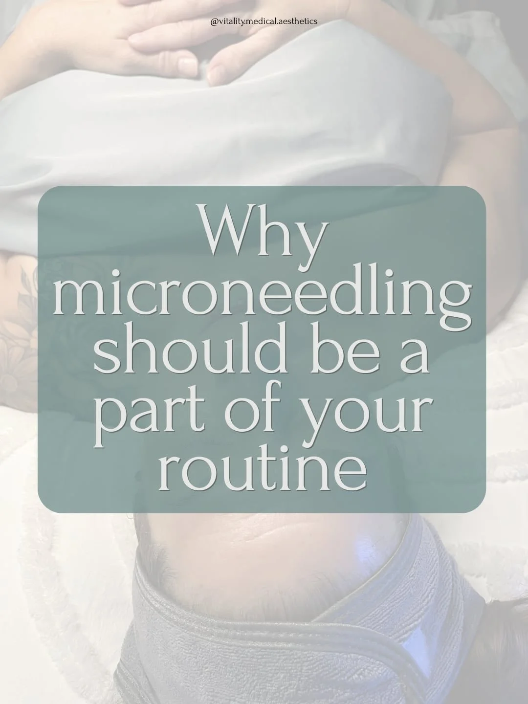 Microneedling boosts your natural collagen production, which will naturally recede over time without intervention. 
-
Want to build on your results and keep seeing improvement in the tone, brightness, and elasticity of your skin? Let&rsquo;s get you 