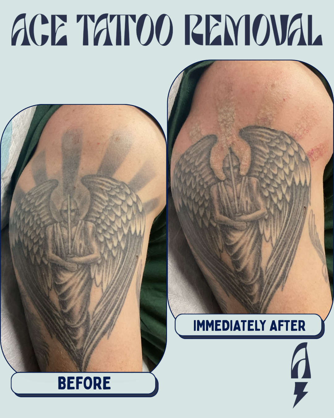 BEFORE & IMMEDIATELY AFTER - 1.png