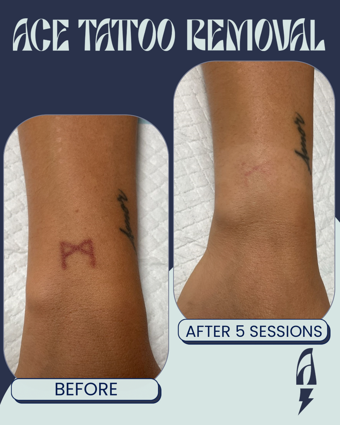 BEFORE & IMMEDIATELY AFTER - 1.png