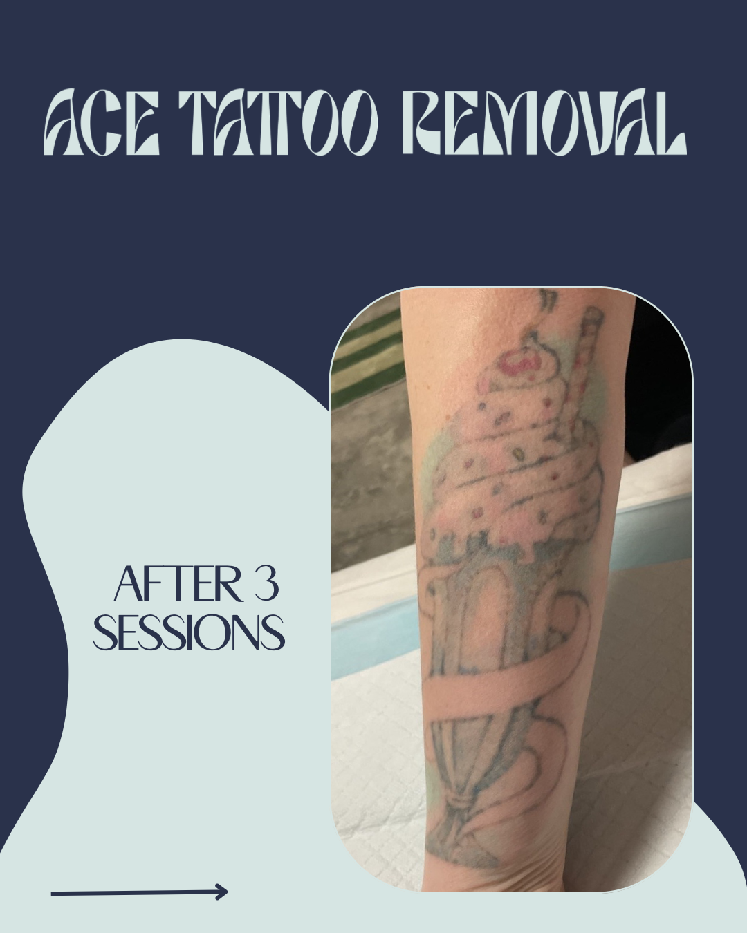 BEFORE & IMMEDIATELY AFTER - 2.png