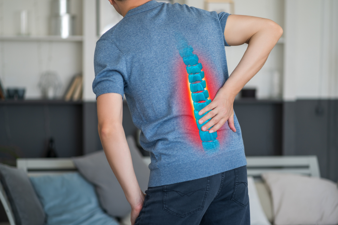 Understanding Herniated Discs: Symptoms, Treatment, and Chiropractic Care