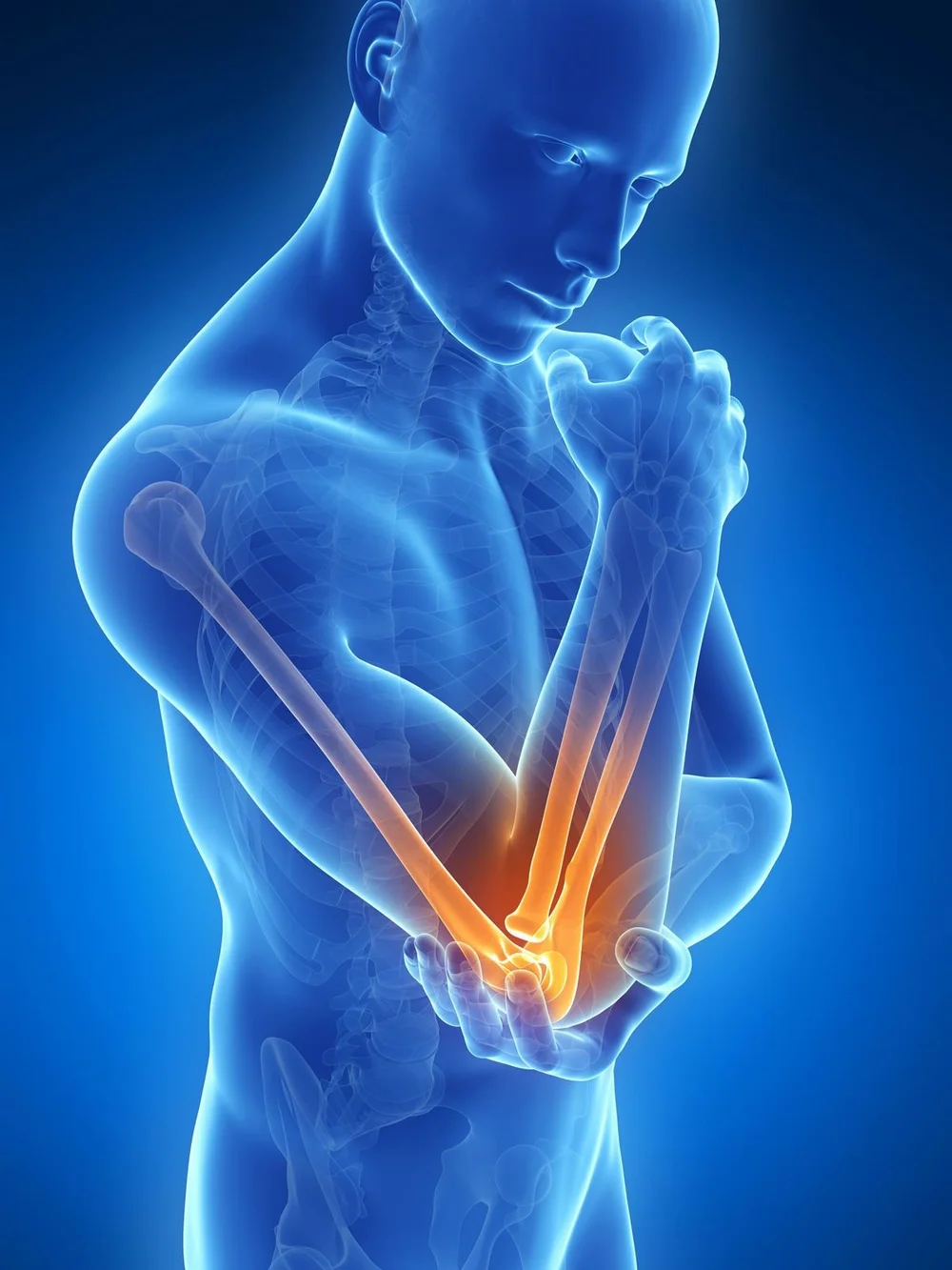 Acupuncture Solves Tennis Elbow — Murphy Chiropractic & Wellness Center