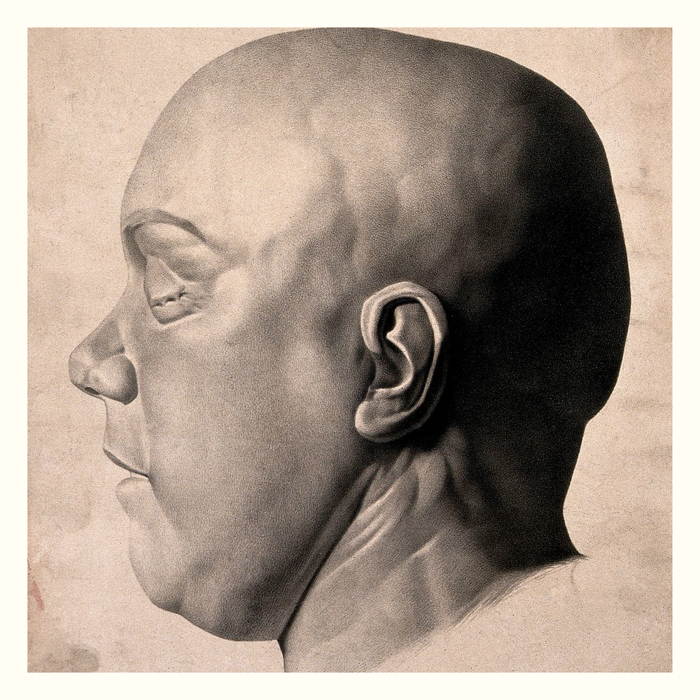 Lithograph of Willam Palmer's death mask
