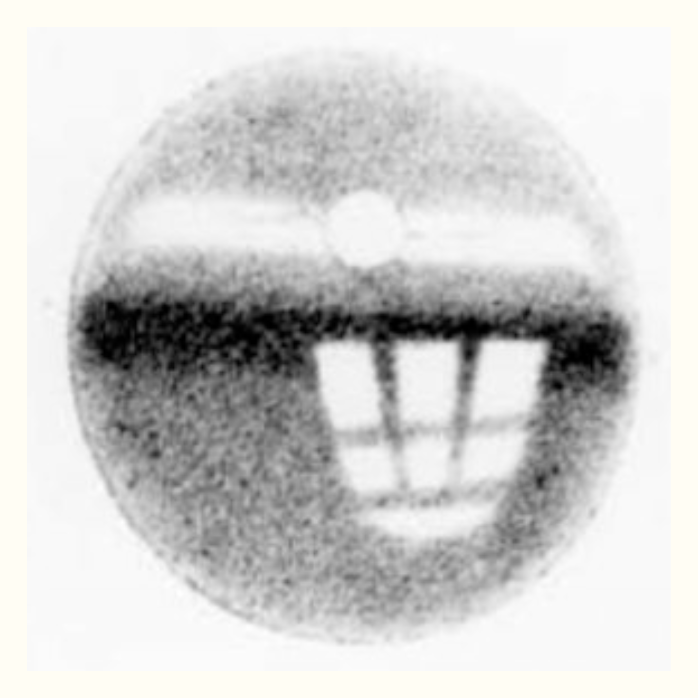 Experimental rabbit optogram from 1878