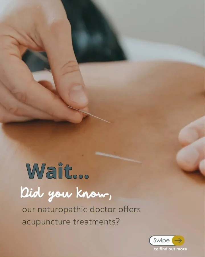 Did you know our Naturopathic Doctor offers acupuncture too? 👀

Acupuncture isn&rsquo;t just for pain&mdash;it can also support your lymphatic system, helping reduce swelling, improve circulation, and get things flowing again (yes, literally).

Seei