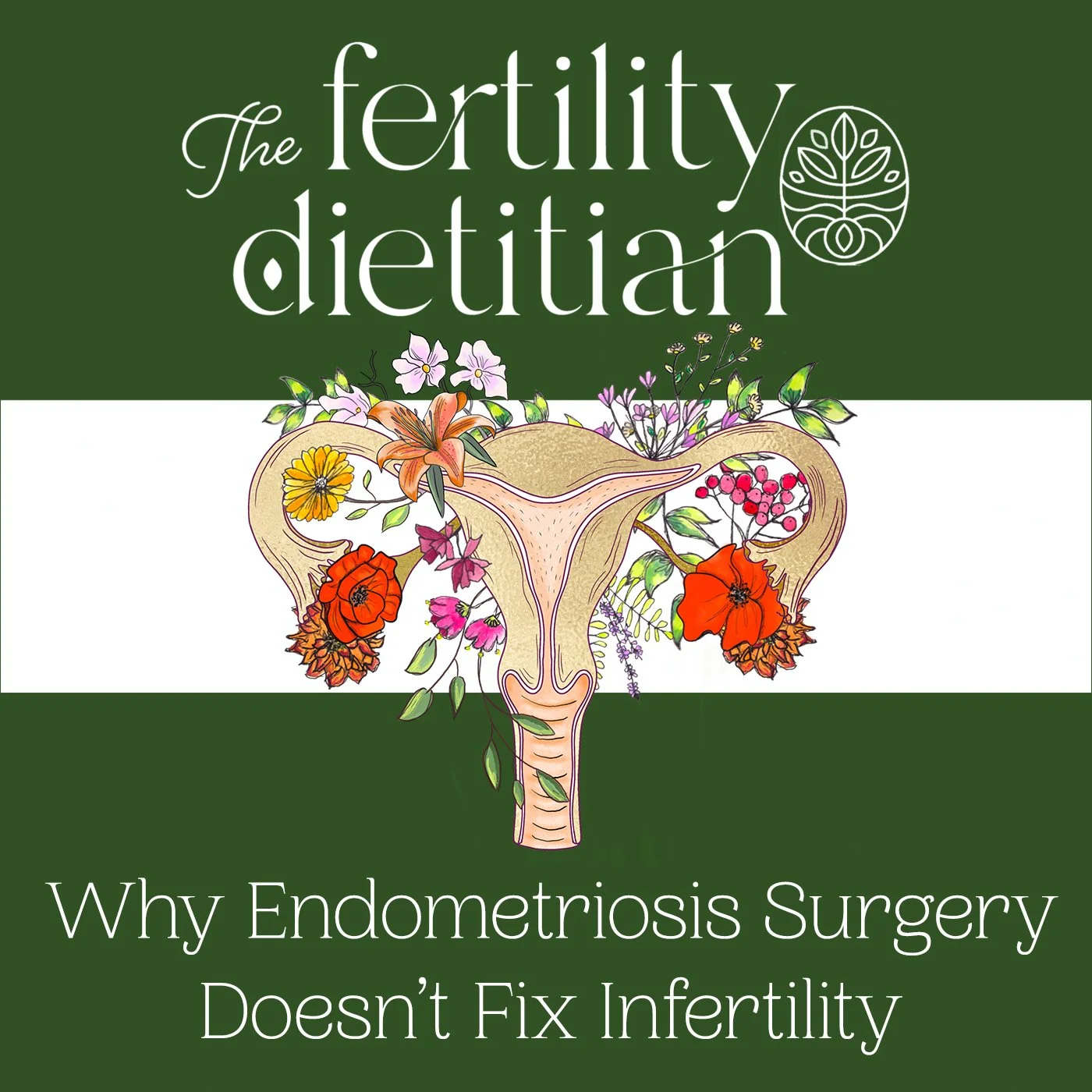 Why Endometriosis Surgery Doesn't Fix Infertility: Excision Surgery, Immune Health, Inflammation, and Natural Fertility Support [EP 74]