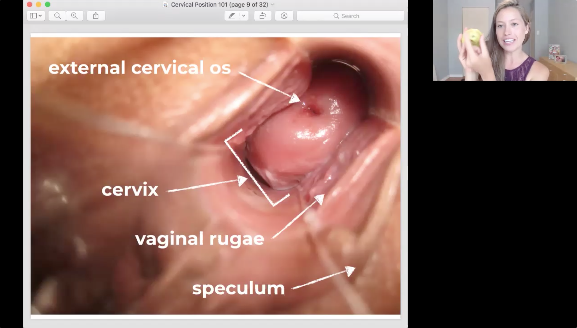 Cervical Position Screen Shot 2.png