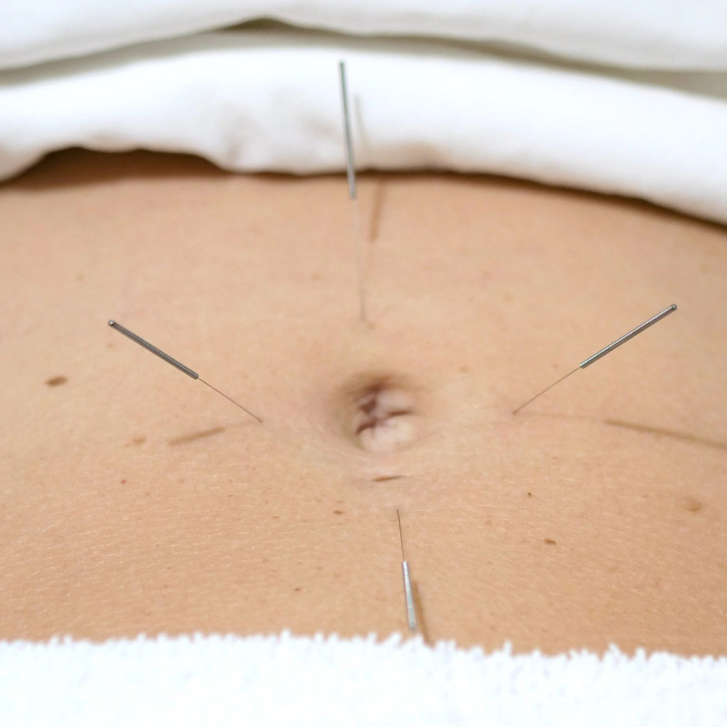CourtneyRoseAcupuncture_acubody_header_vert.jpg