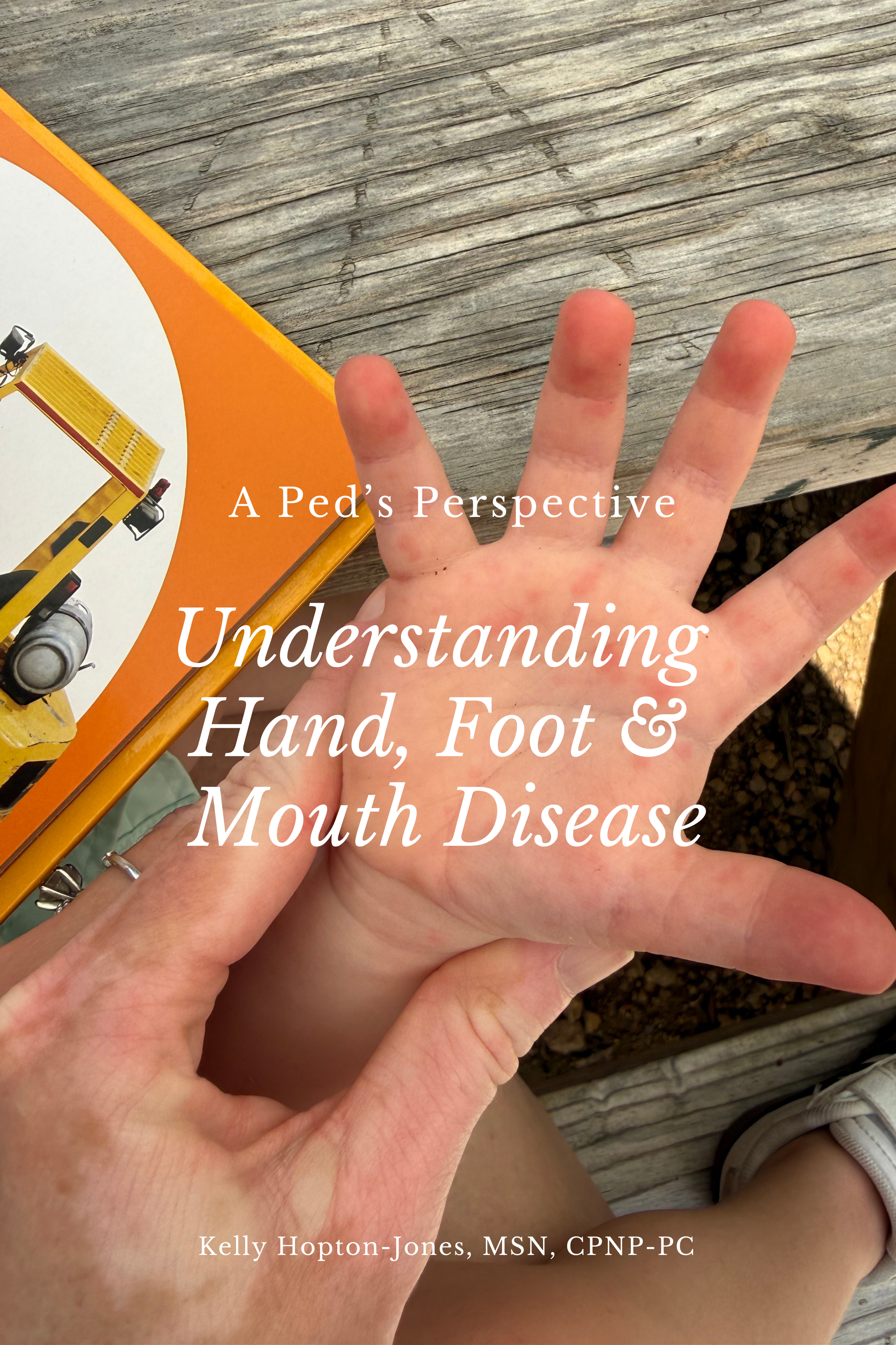 A Ped’s Perspective: Understanding Hand, Foot &amp; Mouth Disease