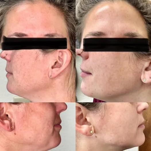 Beyond Vanity: Why Your Esthetician is Your Skincare Savior