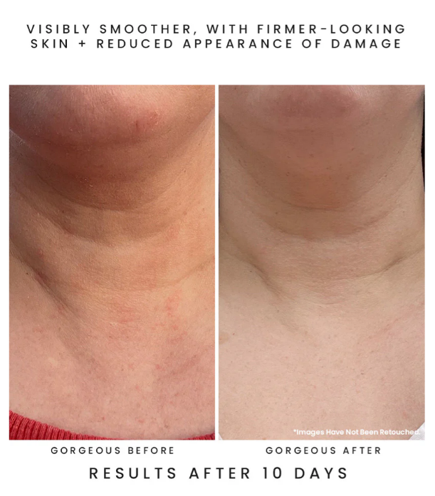 Screenshot 2026-04-03 130027.png