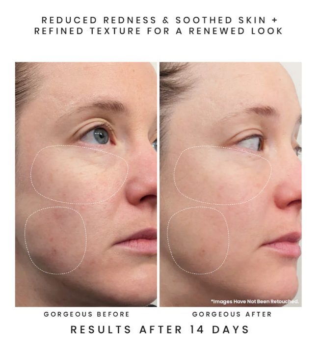 Screenshot 2026-04-04 174000.png