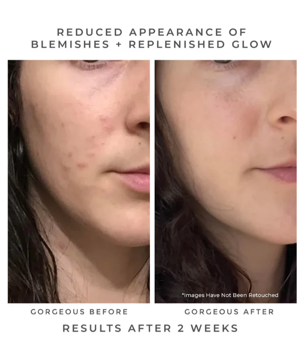 Screenshot 2026-04-04 175027.png