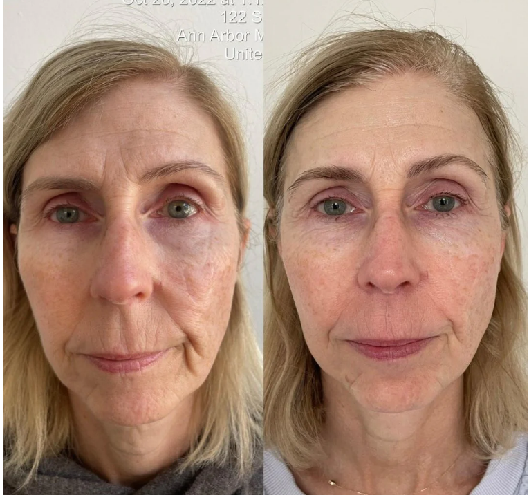 Screenshot 2026-03-21 003510.png