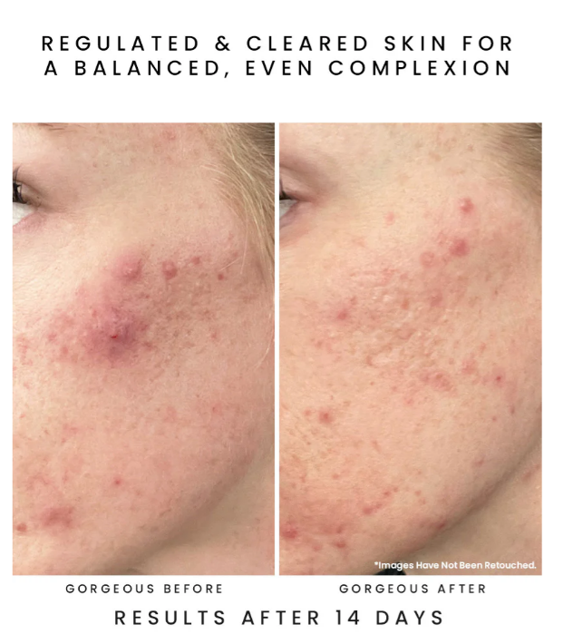 Screenshot 2026-04-04 004237.png