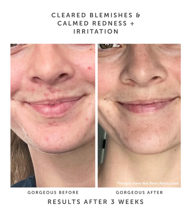 Screenshot 2026-04-04 181049.png