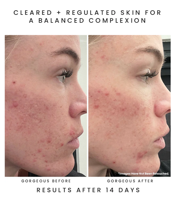 Screenshot 2026-04-03 125302.png