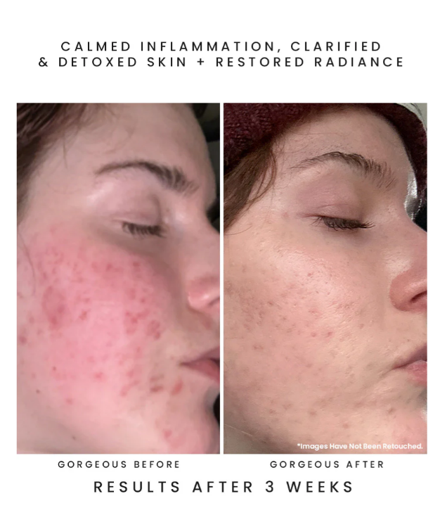 Screenshot 2026-04-04 175516.png