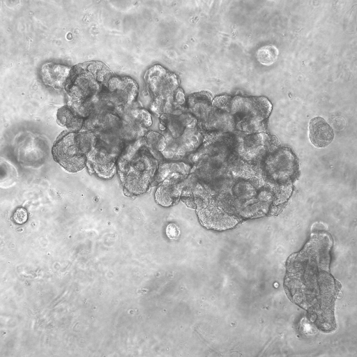 Kidney organoid from 13LGS (credit to Justin Conner)