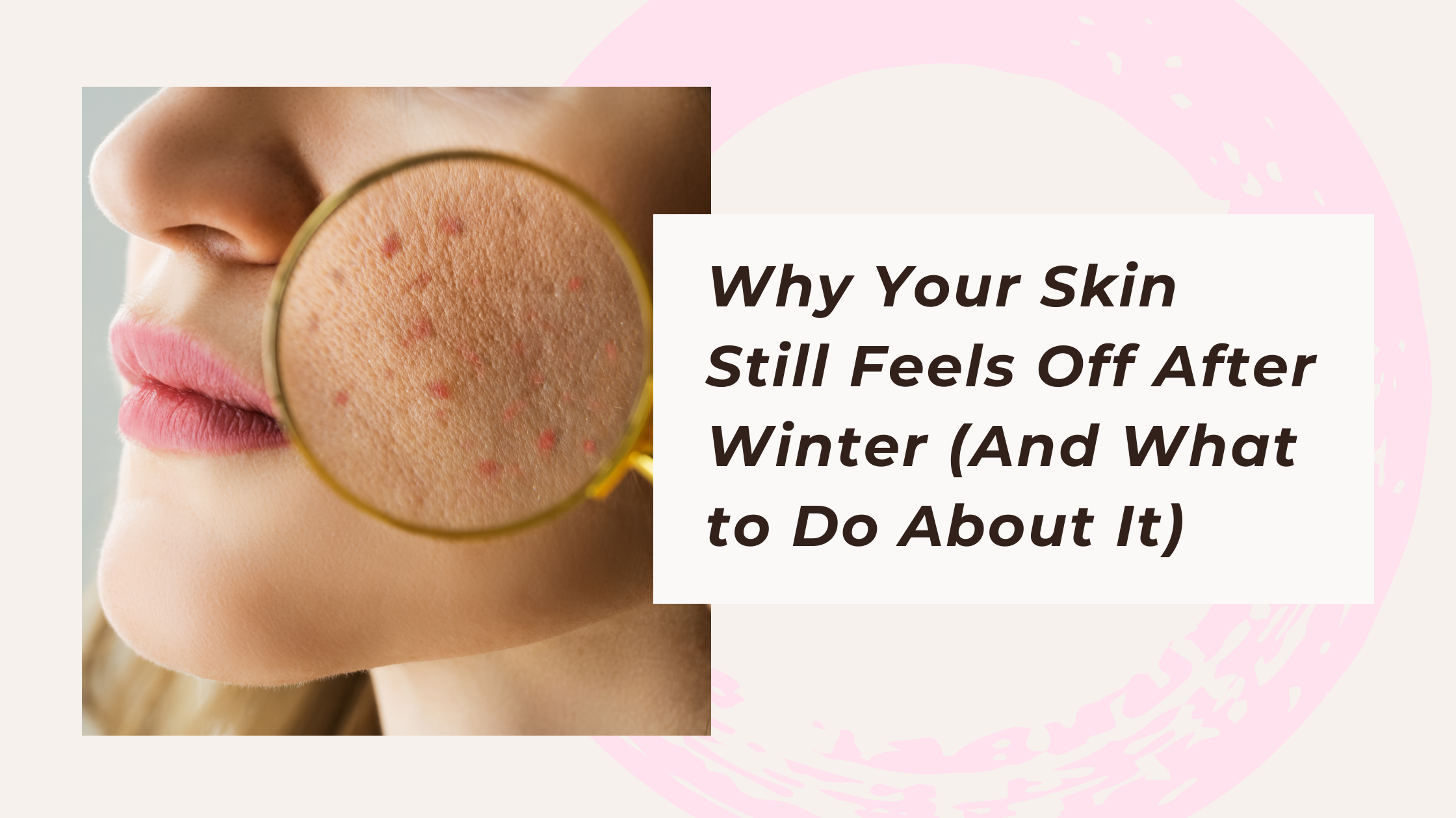 Why Your Skin Still Feels Off After Winter (And What to Do About It in Bridgewater, MA)