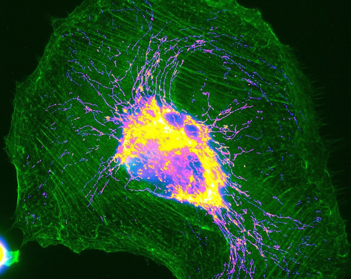 Dillon's image won 1st place on the Pharm Art contest