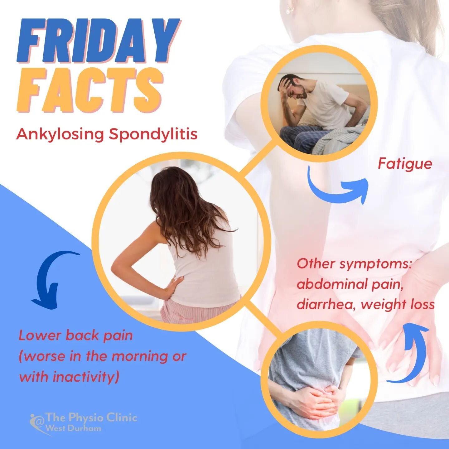 Friday Facts! 💡

Ankylosing Spondylitis (AS) is an inflammatory cause of lower back pain. Symptoms include morning stiffness, pain that is improved with activity, and systemic symptoms such as abdominal pain, nausea, skin rash, etc.

Stay tuned to l