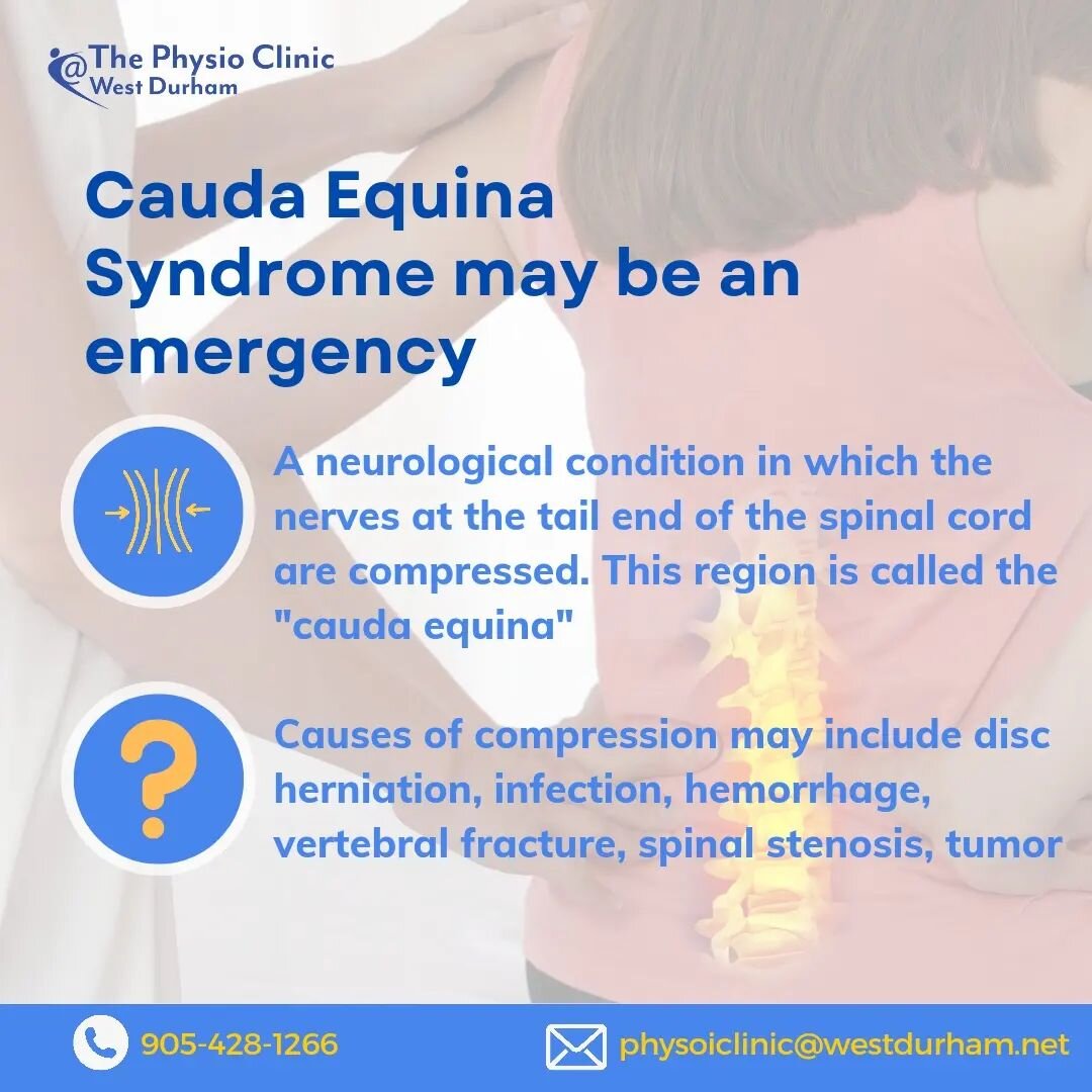 Be in the know about Cauda Equina Syndrome!

This condition may develop slowly or abruptly and may be a medical emergency! Know the signs, symptoms, and management options to prevent complications and a smooth recovery!

Contact us today to book a co
