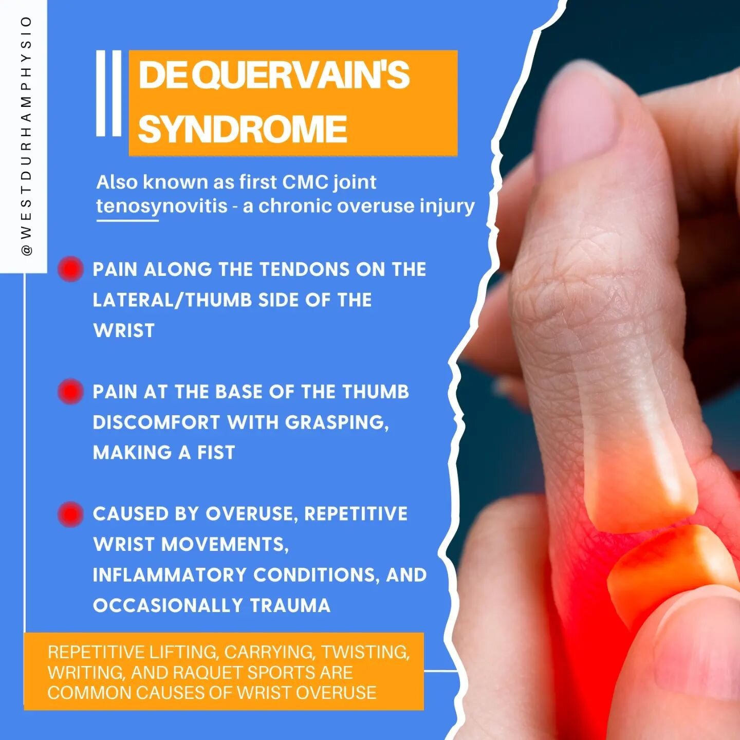 DeQuervain's Syndrome is a common cause of pain at the wrist and/or base of the thumb. It is often referred to as a repetitive overuse injury.

Know the risk factors, symptoms, and treatment options! (Swipe left 👈for more)

Contact us today to book 