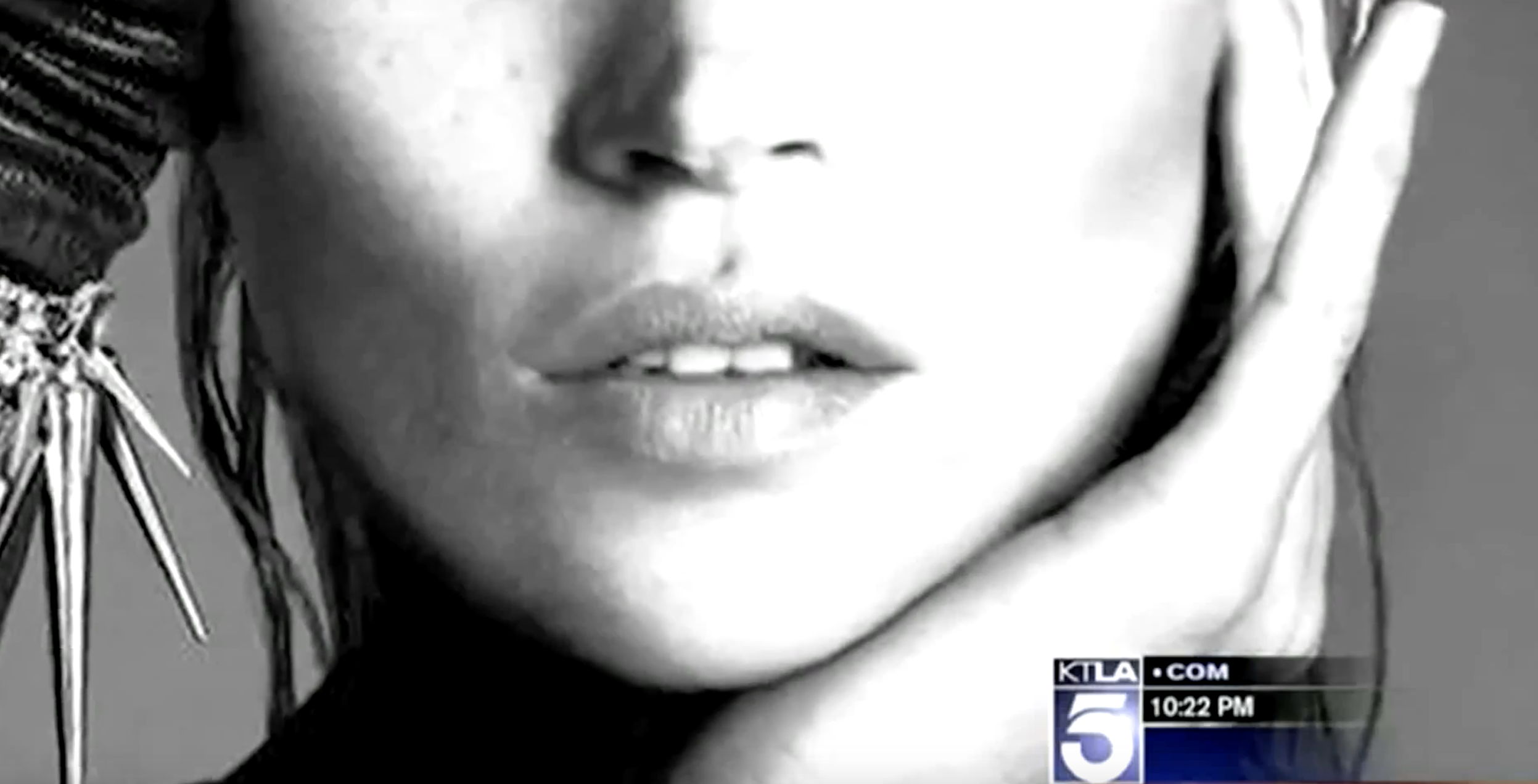 Dr. Garo Kassabian & Voluma Feature on KTLA