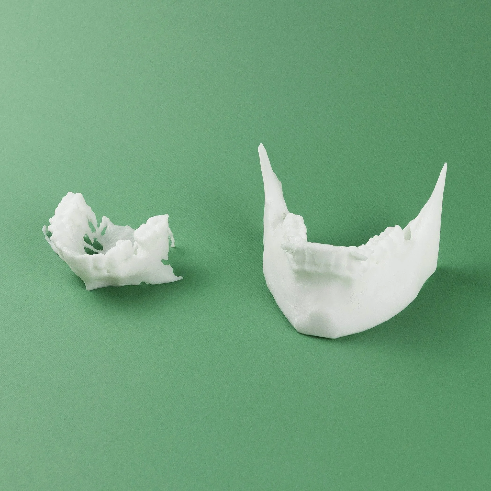 3D printed jaw and teeth in Egypt