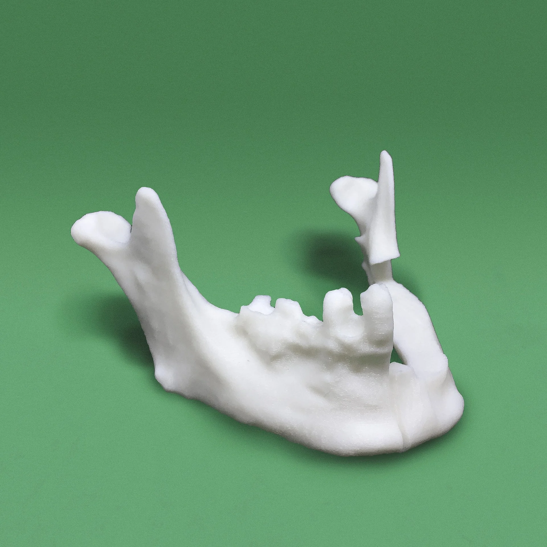 3D printed jaw for a medical field