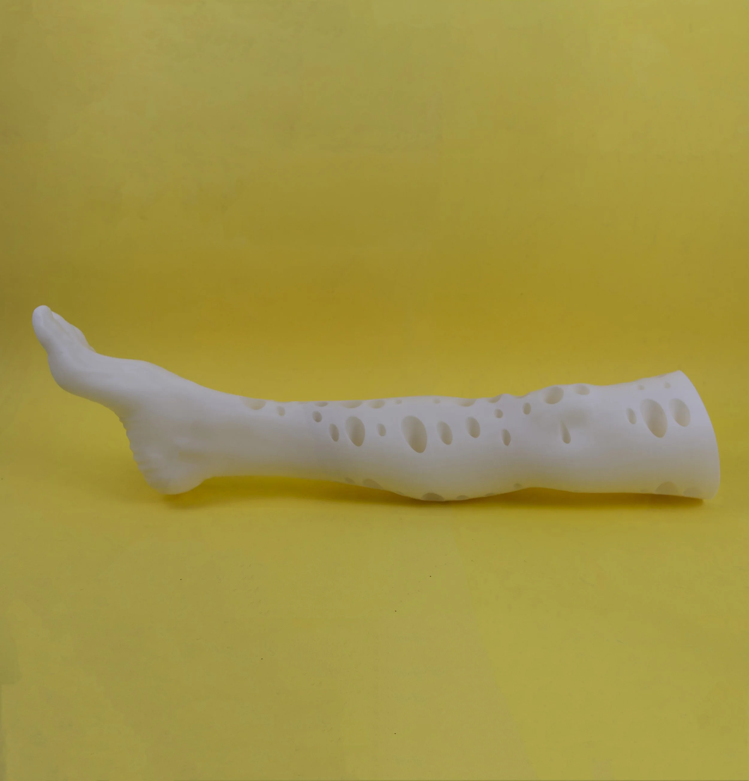 3D printed leg in Egypt