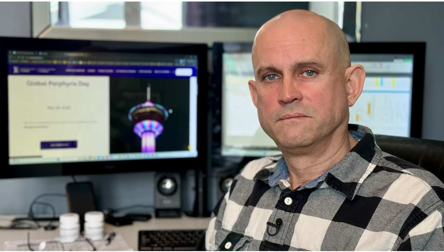 Rare sun disorder kept Saskatoon man indoors for decades until a clinical trial changed everything (Globe and Mail)