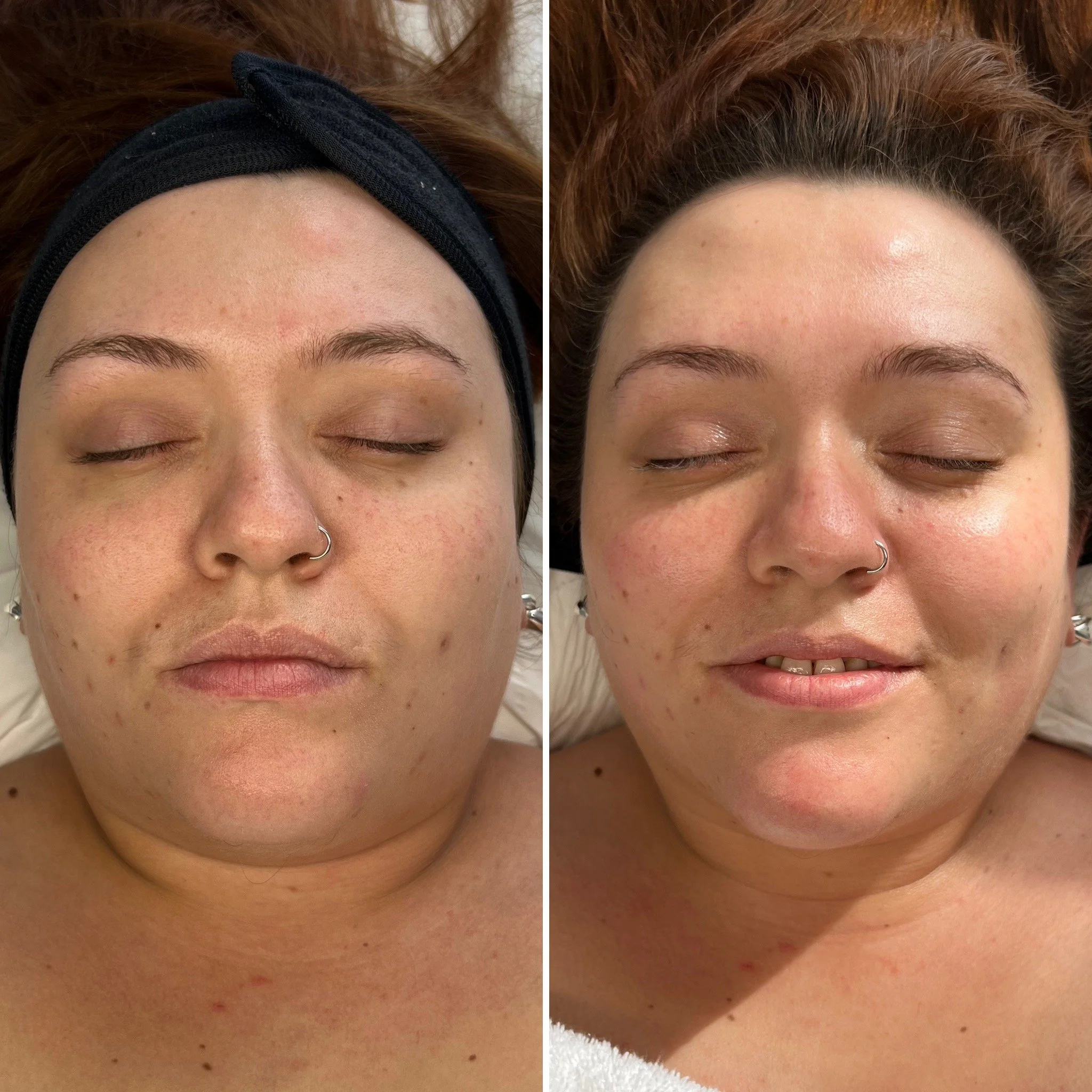 Service: This Facial // Timeline: 1 hour // Concerns: Congestion & dullness