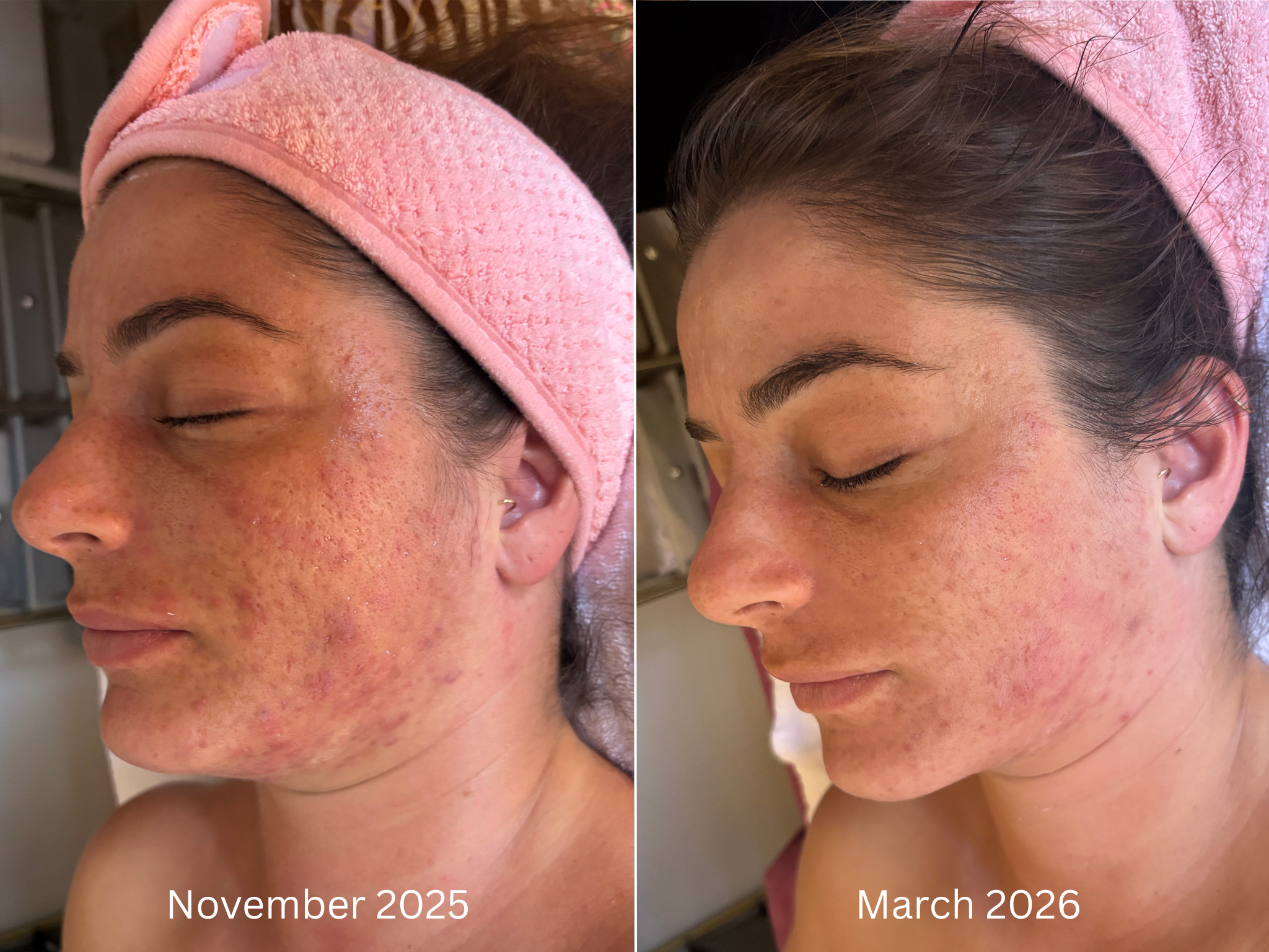 holistic skin transformation kauai