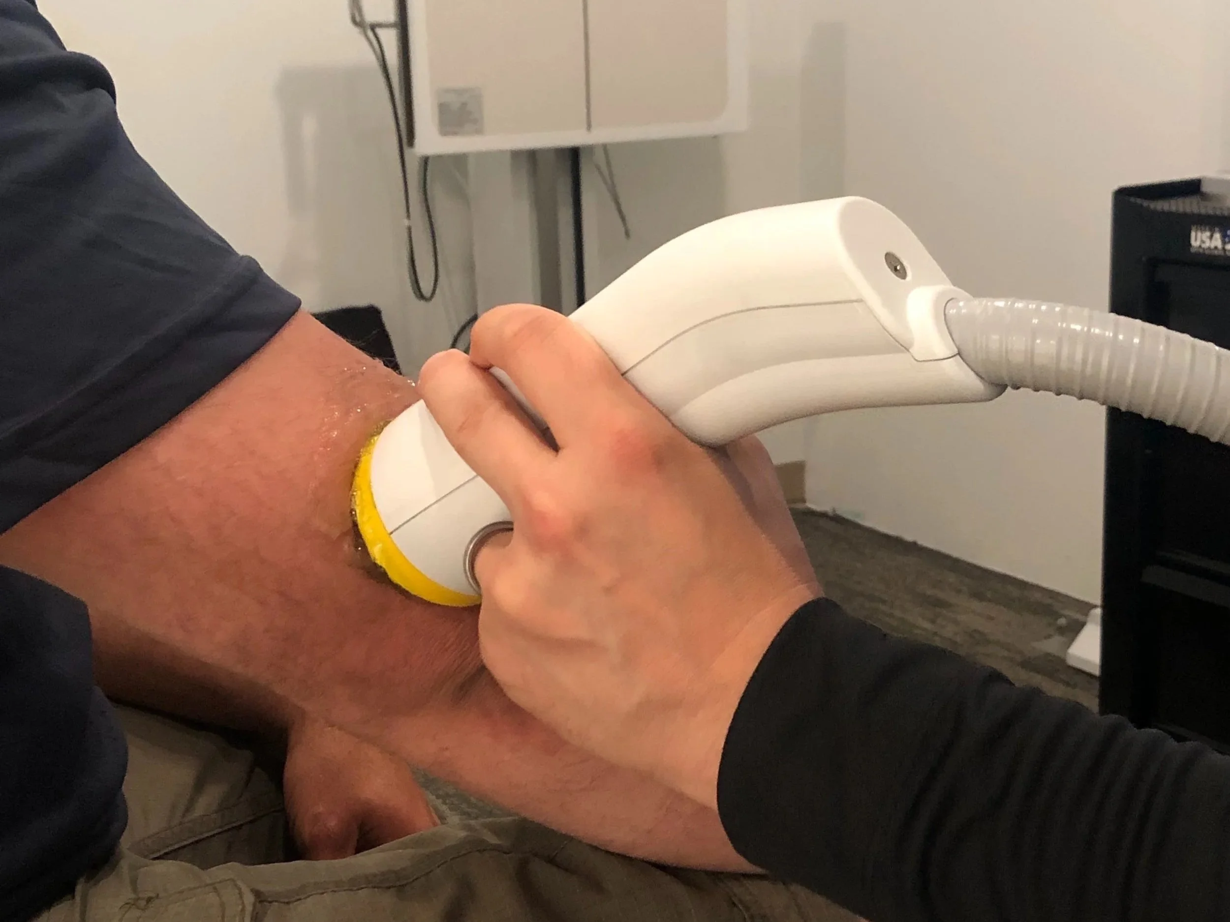 SOFTWAVE THERAPY