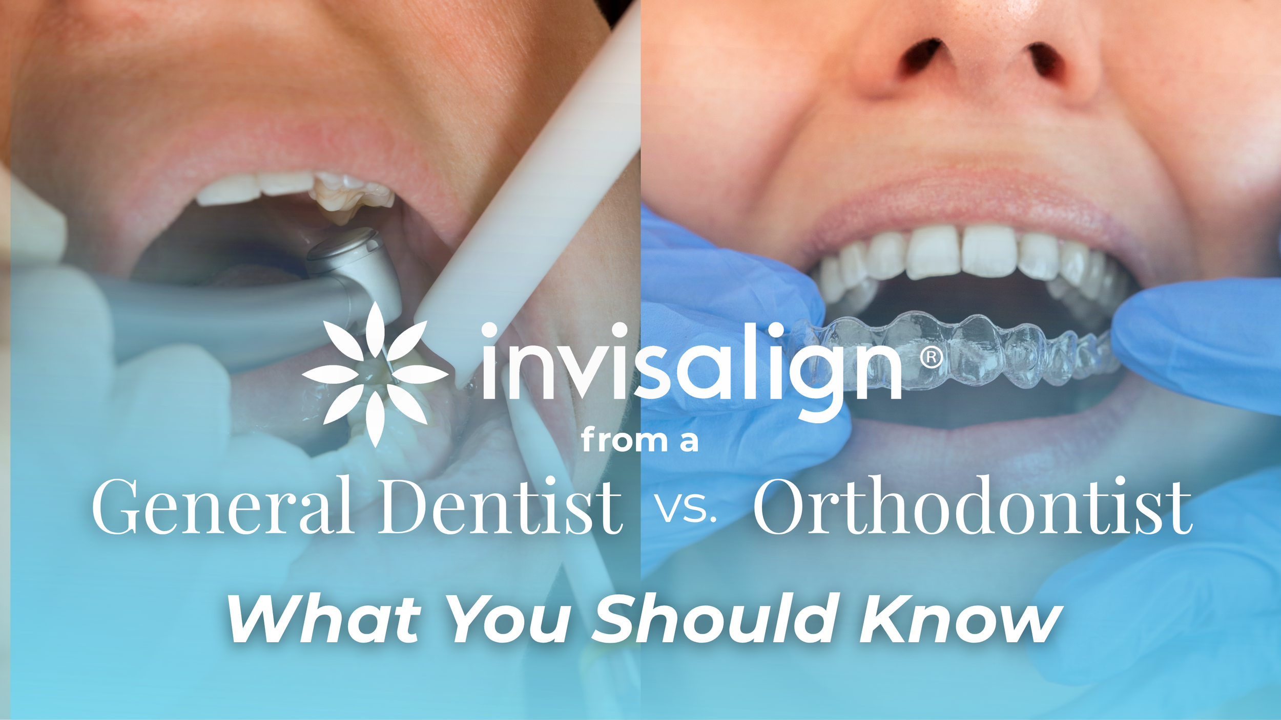 Invisalign From a General Dentist vs. Orthodontist: What Patients Should Know